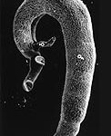 Schistosoma