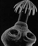 TAENIA-saginata